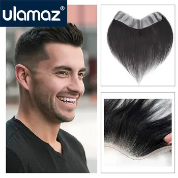 Линия роста волос на лбу, тонкая основа для кожи, нашивка для волос для мужчин, V-образный элемент из человеческих волос, замена линии роста волос на лбу Бесплатная доставка